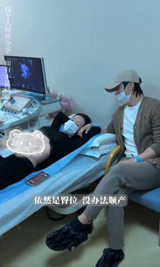 张檬自曝：孕35周胎儿臀位绕颈，剖腹产成无奈之选 -1